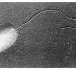 Penyakit Kresek Pada Tanaman  Padi (Oryza sativa L)