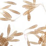 Mikroskopi Jamur Penyebab Becak Ungu Pada Tanaman Bawang Putih