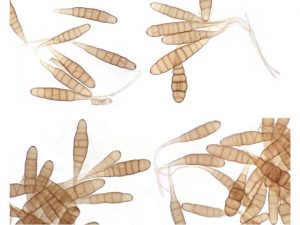 Mikroskopi Jamur Penyebab Becak Ungu Pada Tanaman Bawang Putih