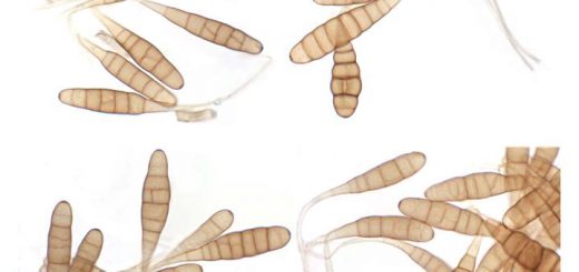 Mikroskopi Jamur Penyebab Becak Ungu Pada Tanaman Bawang Putih