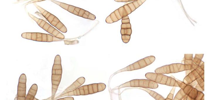 Mikroskopi Jamur Penyebab Becak Ungu Pada Tanaman Bawang Putih